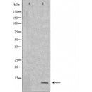 DF6297 at 1/100 staining Mouse testis tissue by IHC-P. The sample was formaldehyde fixed and a heat mediated antigen retrieval step in citrate buffer was performed. The sample was then blocked and incubated with the antibody for 1.5 hours at 22¡ãC. An HRP conjugated goat anti-rabbit antibody was used as the secondary