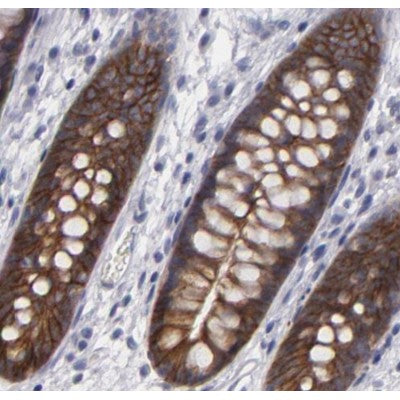 IHC analysis.