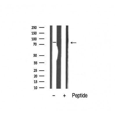 Western blot analysis of Catenin-gamma expression in Hela cell extracts