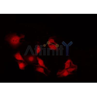 AF0125 staining HeLa by IF/ICC. The sample were fixed with PFA and permeabilized in 0.1% Triton X-100,then blocked in 10% serum for 45 minutes at 25¡ãC. The primary antibody was diluted at 1/200 and incubated with the sample for 1 hour at 37¡ãC. An  Alexa Fluor 594 conjugated goat anti-rabbit IgG (H+L) Ab, diluted at 1/600, was used as the secondary antibod