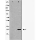 DF6299 at 1/100 staining Mouse muscle tissue by IHC-P. The sample was formaldehyde fixed and a heat mediated antigen retrieval step in citrate buffer was performed. The sample was then blocked and incubated with the antibody for 1.5 hours at 22¡ãC. An HRP conjugated goat anti-rabbit antibody was used as the secondary