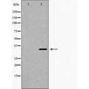 DF6303 at 1/100 staining Mouse pancreas tissue by IHC-P. The sample was formaldehyde fixed and a heat mediated antigen retrieval step in citrate buffer was performed. The sample was then blocked and incubated with the antibody for 1.5 hours at 22¡ãC. An HRP conjugated goat anti-rabbit antibody was used as the secondary