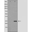 DF6304 at 1/100 staining Mouse lung tissue by IHC-P. The sample was formaldehyde fixed and a heat mediated antigen retrieval step in citrate buffer was performed. The sample was then blocked and incubated with the antibody for 1.5 hours at 22¡ãC. An HRP conjugated goat anti-rabbit antibody was used as the secondary