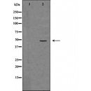 DF6305 at 1/100 staining Rat liver tissue by IHC-P. The sample was formaldehyde fixed and a heat mediated antigen retrieval step in citrate buffer was performed. The sample was then blocked and incubated with the antibody for 1.5 hours at 22¡ãC. An HRP conjugated goat anti-rabbit antibody was used as the secondary