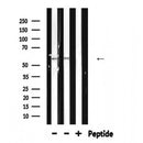 DF6312 at 1/100 staining Human brain tissue by IHC-P. The sample was formaldehyde fixed and a heat mediated antigen retrieval step in citrate buffer was performed. The sample was then blocked and incubated with the antibody for 1.5 hours at 22¡ãC. An HRP conjugated goat anti-rabbit antibody was used as the secondary