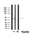 DF6313 at 1/100 staining Human Melanoma tissue by IHC-P. The sample was formaldehyde fixed and a heat mediated antigen retrieval step in citrate buffer was performed. The sample was then blocked and incubated with the antibody for 1.5 hours at 22¡ãC. An HRP conjugated goat anti-rabbit antibody was used as the secondary
