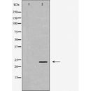DF6314 at 1/100 staining Human prostate tissue by IHC-P. The sample was formaldehyde fixed and a heat mediated antigen retrieval step in citrate buffer was performed. The sample was then blocked and incubated with the antibody for 1.5 hours at 22¡ãC. An HRP conjugated goat anti-rabbit antibody was used as the secondary