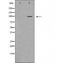 DF6318 at 1/100 staining Human kidney tissue by IHC-P. The sample was formaldehyde fixed and a heat mediated antigen retrieval step in citrate buffer was performed. The sample was then blocked and incubated with the antibody for 1.5 hours at 22¡ãC. An HRP conjugated goat anti-rabbit antibody was used as the secondary