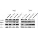 DF6322 at 1/100 staining Human prostate tissue by IHC-P. The sample was formaldehyde fixed and a heat mediated antigen retrieval step in citrate buffer was performed. The sample was then blocked and incubated with the antibody for 1.5 hours at 22¡ãC. An HRP conjugated goat anti-rabbit antibody was used as the secondary