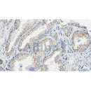 Western blot analysis of extracts from Mouse  liver, using KRAS Antibody. The lane on the left was treated with blocking peptide.