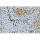 Western blot analysis of extracts from various samples, using HGF Antibody.
 Lane 1: Hela treated with blocking peptide.
 Lane 2: Hela;
 Lane 3: Mouse Myeloma cell;
 