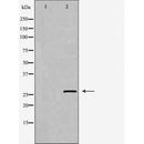 DF6328 staining NIH-3T3 cells by IF/ICC. The sample were fixed with PFA and permeabilized in 0.1% Triton X-100,then blocked in 10% serum for 45 minutes at 25¡ãC. The primary antibody was diluted at 1/200 and incubated with the sample for 1 hour at 37¡ãC. An  Alexa Fluor 594 conjugated goat anti-rabbit IgG (H+L) antibody(Cat.