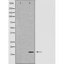 DF6329 at 1/100 staining Mouse kidney tissue by IHC-P. The sample was formaldehyde fixed and a heat mediated antigen retrieval step in citrate buffer was performed. The sample was then blocked and incubated with the antibody for 1.5 hours at 22¡ãC. An HRP conjugated goat anti-rabbit antibody was used as the secondary