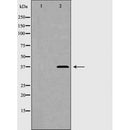 DF6332 at 1/100 staining Human lymph tissue by IHC-P. The sample was formaldehyde fixed and a heat mediated antigen retrieval step in citrate buffer was performed. The sample was then blocked and incubated with the antibody for 1.5 hours at 22¡ãC. An HRP conjugated goat anti-rabbit antibody was used as the secondary