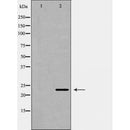 DF6333 at 1/100 staining Human uterus tissue by IHC-P. The sample was formaldehyde fixed and a heat mediated antigen retrieval step in citrate buffer was performed. The sample was then blocked and incubated with the antibody for 1.5 hours at 22¡ãC. An HRP conjugated goat anti-rabbit antibody was used as the secondary