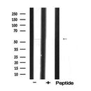DF6334 at 1/100 staining Human uterus tissue by IHC-P. The sample was formaldehyde fixed and a heat mediated antigen retrieval step in citrate buffer was performed. The sample was then blocked and incubated with the antibody for 1.5 hours at 22¡ãC. An HRP conjugated goat anti-rabbit antibody was used as the secondary