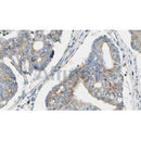 Western blot analysis of extracts from Mouse  liver, using TPM3  Antibody. The lane on the left was treated with blocking peptide.