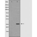 DF6339 at 1/100 staining Mouse muscle tissue by IHC-P. The sample was formaldehyde fixed and a heat mediated antigen retrieval step in citrate buffer was performed. The sample was then blocked and incubated with the antibody for 1.5 hours at 22¡ãC. An HRP conjugated goat anti-rabbit antibody was used as the secondary