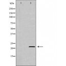 DF6350 at 1/100 staining Human prostate tissue by IHC-P. The sample was formaldehyde fixed and a heat mediated antigen retrieval step in citrate buffer was performed. The sample was then blocked and incubated with the antibody for 1.5 hours at 22¡ãC. An HRP conjugated goat anti-rabbit antibody was used as the secondary