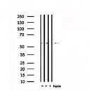 DF6351 at 1/100 staining Mouse brain tissue by IHC-P. The sample was formaldehyde fixed and a heat mediated antigen retrieval step in citrate buffer was performed. The sample was then blocked and incubated with the antibody for 1.5 hours at 22¡ãC. An HRP conjugated goat anti-rabbit antibody was used as the secondary