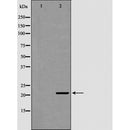 DF6353 at 1/100 staining Mouse liver tissue by IHC-P. The sample was formaldehyde fixed and a heat mediated antigen retrieval step in citrate buffer was performed. The sample was then blocked and incubated with the antibody for 1.5 hours at 22¡ãC. An HRP conjugated goat anti-rabbit antibody was used as the secondary