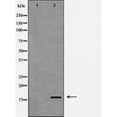 DF6356 at 1/100 staining Mouse testis tissue by IHC-P. The sample was formaldehyde fixed and a heat mediated antigen retrieval step in citrate buffer was performed. The sample was then blocked and incubated with the antibody for 1.5 hours at 22¡ãC. An HRP conjugated goat anti-rabbit antibody was used as the secondary