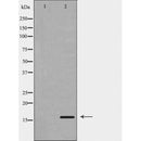 DF6366 at 1/100 staining Human pancreas tissue by IHC-P. The sample was formaldehyde fixed and a heat mediated antigen retrieval step in citrate buffer was performed. The sample was then blocked and incubated with the antibody for 1.5 hours at 22¡ãC. An HRP conjugated goat anti-rabbit antibody was used as the secondary