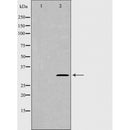 DF6367 at 1/100 staining Human uterus tissue by IHC-P. The sample was formaldehyde fixed and a heat mediated antigen retrieval step in citrate buffer was performed. The sample was then blocked and incubated with the antibody for 1.5 hours at 22¡ãC. An HRP conjugated goat anti-rabbit antibody was used as the secondary