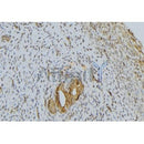 Western blot analysis of extracts from mouse brain, using PRSS1 Antibody. The lane on the right was treated with blocking peptide.