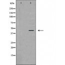 DF6375 at 1/100 staining Mouse lung tissue by IHC-P. The sample was formaldehyde fixed and a heat mediated antigen retrieval step in citrate buffer was performed. The sample was then blocked and incubated with the antibody for 1.5 hours at 22¡ãC. An HRP conjugated goat anti-rabbit antibody was used as the secondary