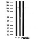 DF6378 at 1/100 staining Human lung tissue by IHC-P. The sample was formaldehyde fixed and a heat mediated antigen retrieval step in citrate buffer was performed. The sample was then blocked and incubated with the antibody for 1.5 hours at 22¡ãC. An HRP conjugated goat anti-rabbit antibody was used as the secondary