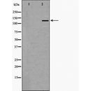 DF6379 at 1/100 staining Mouse liver tissue by IHC-P. The sample was formaldehyde fixed and a heat mediated antigen retrieval step in citrate buffer was performed. The sample was then blocked and incubated with the antibody for 1.5 hours at 22¡ãC. An HRP conjugated goat anti-rabbit antibody was used as the secondary