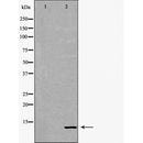 DF6380 at 1/100 staining Human prostate tissue by IHC-P. The sample was formaldehyde fixed and a heat mediated antigen retrieval step in citrate buffer was performed. The sample was then blocked and incubated with the antibody for 1.5 hours at 22¡ãC. An HRP conjugated goat anti-rabbit antibody was used as the secondary