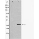 DF6385 at 1/100 staining Human lymph node tissue by IHC-P. The sample was formaldehyde fixed and a heat mediated antigen retrieval step in citrate buffer was performed. The sample was then blocked and incubated with the antibody for 1.5 hours at 22¡ãC. An HRP conjugated goat anti-rabbit antibody was used as the secondary