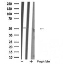DF6393 at 1/100 staining Mouse liver tissue by IHC-P. The sample was formaldehyde fixed and a heat mediated antigen retrieval step in citrate buffer was performed. The sample was then blocked and incubated with the antibody for 1.5 hours at 22¡ãC. An HRP conjugated goat anti-rabbit antibody was used as the secondary