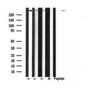 DF6397 at 1/100 staining Human uterus tissue by IHC-P. The sample was formaldehyde fixed and a heat mediated antigen retrieval step in citrate buffer was performed. The sample was then blocked and incubated with the antibody for 1.5 hours at 22¡ãC. An HRP conjugated goat anti-rabbit antibody was used as the secondary