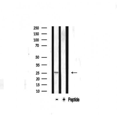 Western blot analysis on mouse liver lysate using Caveolin-1 Antibody