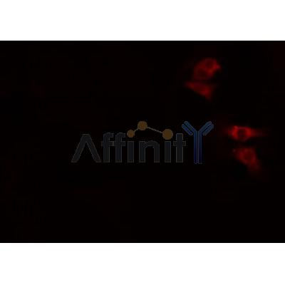 AF0126 staining A549 cells by IF/ICC. The sample were fixed with PFA and permeabilized in 0.1% Triton X-100,then blocked in 10% serum for 45 minutes at 25¡ãC. The primary antibody was diluted at 1/200 and incubated with the sample for 1 hour at 37¡ãC. An  Alexa Fluor 594 conjugated goat anti-rabbit IgG (H+L) antibody(Cat.