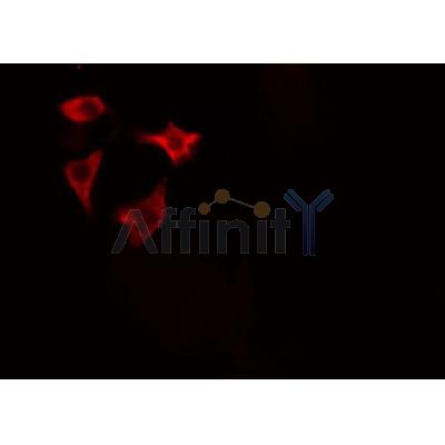 AF0126 staining HuvEc cells by IF/ICC. The sample were fixed with PFA and permeabilized in 0.1% Triton X-100,then blocked in 10% serum for 45 minutes at 25¡ãC. The primary antibody was diluted at 1/200 and incubated with the sample for 1 hour at 37¡ãC. An  Alexa Fluor 594 conjugated goat anti-rabbit IgG (H+L) antibody(Cat.
