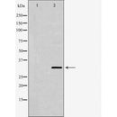 DF6400 at 1/100 staining Human pancreas tissue by IHC-P. The sample was formaldehyde fixed and a heat mediated antigen retrieval step in citrate buffer was performed. The sample was then blocked and incubated with the antibody for 1.5 hours at 22¡ãC. An HRP conjugated goat anti-rabbit antibody was used as the secondary