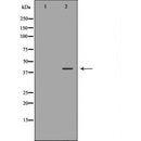 DF6401 at 1/100 staining Mouse lung tissue by IHC-P. The sample was formaldehyde fixed and a heat mediated antigen retrieval step in citrate buffer was performed. The sample was then blocked and incubated with the antibody for 1.5 hours at 22¡ãC. An HRP conjugated goat anti-rabbit antibody was used as the secondary