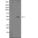 DF6418 at 1/100 staining Human heart tissue by IHC-P. The sample was formaldehyde fixed and a heat mediated antigen retrieval step in citrate buffer was performed. The sample was then blocked and incubated with the antibody for 1.5 hours at 22¡ãC. An HRP conjugated goat anti-rabbit antibody was used as the secondary