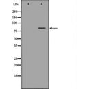 DF6422 staining HUVEC by IF/ICC. The sample were fixed with PFA and permeabilized in 0.1% Triton X-100,then blocked in 10% serum for 45 minutes at 25¡ãC. The primary antibody was diluted at 1/200 and incubated with the sample for 1 hour at 37¡ãC. An  Alexa Fluor 594 conjugated goat anti-rabbit IgG (H+L) Ab, diluted at 1/600, was used as the secondary antibod