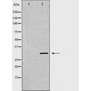 DF6425 at 1/100 staining Human gastric tissue by IHC-P. The sample was formaldehyde fixed and a heat mediated antigen retrieval step in citrate buffer was performed. The sample was then blocked and incubated with the antibody for 1.5 hours at 22¡ãC. An HRP conjugated goat anti-rabbit antibody was used as the secondary