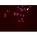 Western blot analysis of extracts from rat brain, using TLR8  Antibody. Lane 1 was treated with the antigen-specific peptide.