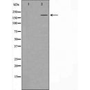 Western blot analysis of extracts of A431 , using TET1 antibody. The lane on the left is treated with the antigen-specific peptide.