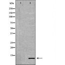 DF6431 staining HepG2 by IF/ICC. The sample were fixed with PFA and permeabilized in 0.1% Triton X-100,then blocked in 10% serum for 45 minutes at 25¡ãC. The primary antibody was diluted at 1/200 and incubated with the sample for 1 hour at 37¡ãC. An  Alexa Fluor 594 conjugated goat anti-rabbit IgG (H+L) Ab, diluted at 1/600, was used as the secondary antibod