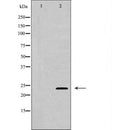 DF6432 at 1/100 staining Human uterus tissue by IHC-P. The sample was formaldehyde fixed and a heat mediated antigen retrieval step in citrate buffer was performed. The sample was then blocked and incubated with the antibody for 1.5 hours at 22¡ãC. An HRP conjugated goat anti-rabbit antibody was used as the secondary