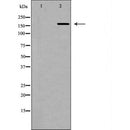 DF6434 at 1/100 staining Human uterus tissue by IHC-P. The sample was formaldehyde fixed and a heat mediated antigen retrieval step in citrate buffer was performed. The sample was then blocked and incubated with the antibody for 1.5 hours at 22¡ãC. An HRP conjugated goat anti-rabbit antibody was used as the secondary