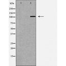 DF6435 at 1/100 staining Mouse testis tissue by IHC-P. The sample was formaldehyde fixed and a heat mediated antigen retrieval step in citrate buffer was performed. The sample was then blocked and incubated with the antibody for 1.5 hours at 22¡ãC. An HRP conjugated goat anti-rabbit antibody was used as the secondary